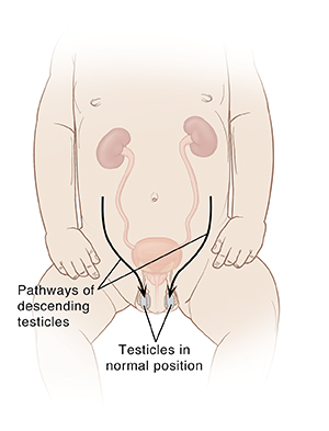Front view of infant showing urinary system and pathways of descending testicles.