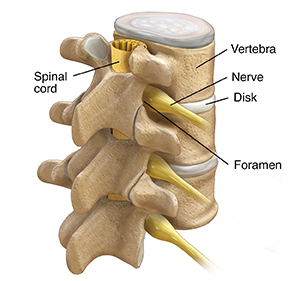 Three-quarter view of three lumbar vertebrae and disks showing spinal cord and spinal nerves.