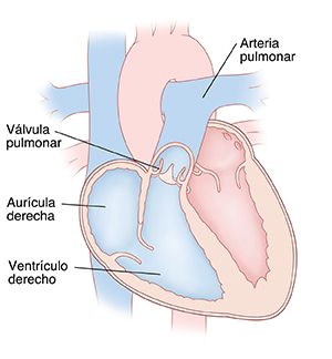 Corte transversal de un corazón en donde se ven la arteria pulmonar, la válvula pulmonar, la aurícula derecha y el ventrículo derecho.